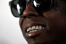 lil-Waynes-teeth.webp