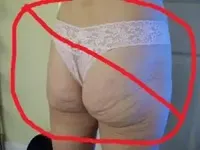 saggy-butt.webp